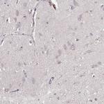 GRAP2 Polyclonal Antibody