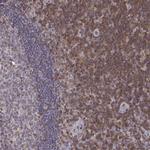 GRAP2 Antibody in Immunohistochemistry (Paraffin) (IHC (P))