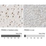 PRDM2 Antibody in Immunohistochemistry (Paraffin) (IHC (P))