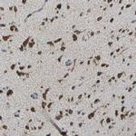 ECH1 Antibody in Immunohistochemistry (Paraffin) (IHC (P))