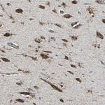 ECH1 Antibody in Immunohistochemistry (Paraffin) (IHC (P))