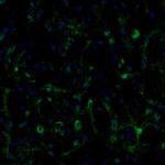 ECH1 Antibody in Immunohistochemistry (Paraffin) (IHC (P))