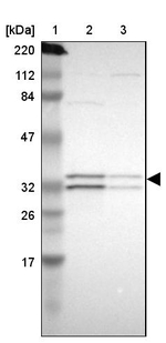 ECH1 Antibody in Western Blot (WB)