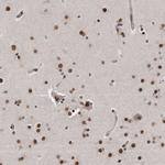 p53DINP1 Antibody in Immunohistochemistry (Paraffin) (IHC (P))