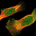 IkB epsilon Polyclonal Antibody