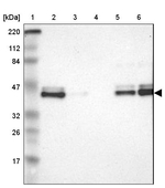 IkB epsilon Antibody in Western Blot (WB)
