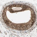 CK2 beta Antibody in Immunohistochemistry (Paraffin) (IHC (P))