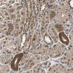 CK2 beta Antibody in Immunohistochemistry (Paraffin) (IHC (P))