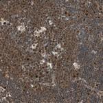 CK2 beta Polyclonal Antibody