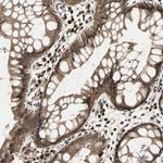 CK2 beta Antibody in Immunohistochemistry (Paraffin) (IHC (P))