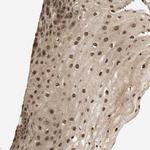 CK2 beta Antibody in Immunohistochemistry (Paraffin) (IHC (P))