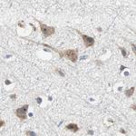 TCP-1 epsilon Antibody in Immunohistochemistry (Paraffin) (IHC (P))