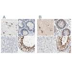 TCP-1 epsilon Antibody in Immunohistochemistry (Paraffin) (IHC (P))