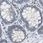 TCP-1 epsilon Antibody in Immunohistochemistry (Paraffin) (IHC (P))
