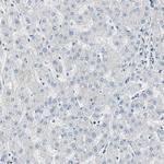 TCP-1 epsilon Antibody in Immunohistochemistry (Paraffin) (IHC (P))