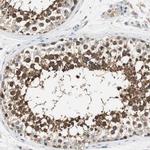 TCP-1 epsilon Antibody in Immunohistochemistry (Paraffin) (IHC (P))