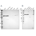 TCP-1 epsilon Antibody in Western Blot (WB)
