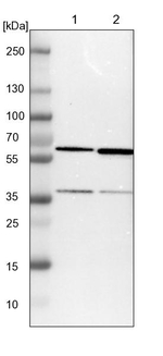 TCP-1 epsilon Antibody in Western Blot (WB)