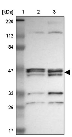 PARVA Antibody in Western Blot (WB)