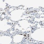 P-Selectin Antibody in Immunohistochemistry (Paraffin) (IHC (P))