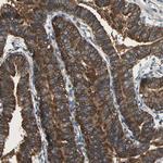 Mu-Calpain Antibody in Immunohistochemistry (Paraffin) (IHC (P))