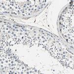 Mu-Calpain Antibody in Immunohistochemistry (Paraffin) (IHC (P))