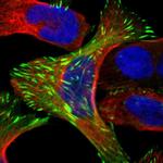 FHL2 Polyclonal Antibody