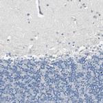 FHL2 Antibody in Immunohistochemistry (Paraffin) (IHC (P))