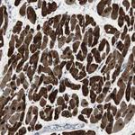 FHL2 Antibody in Immunohistochemistry (Paraffin) (IHC (P))