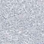 FHL2 Antibody in Immunohistochemistry (Paraffin) (IHC (P))
