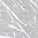 FHL2 Antibody in Immunohistochemistry (Paraffin) (IHC (P))