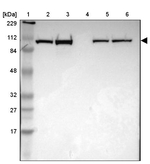 alpha Actinin 1 Antibody in Western Blot (WB)