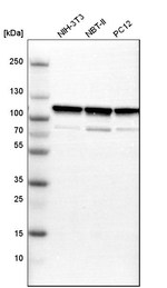 alpha Actinin 1 Antibody in Western Blot (WB)