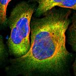 Filamin 2 Polyclonal Antibody