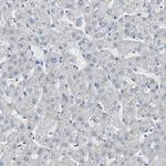 Filamin 2 Antibody in Immunohistochemistry (Paraffin) (IHC (P))