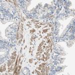 Filamin 2 Antibody in Immunohistochemistry (Paraffin) (IHC (P))