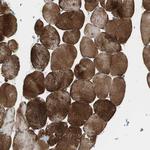 Filamin 2 Antibody in Immunohistochemistry (Paraffin) (IHC (P))