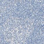 Filamin 2 Antibody in Immunohistochemistry (Paraffin) (IHC (P))