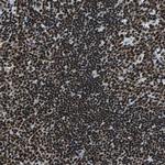 FUBP1 Antibody in Immunohistochemistry (Paraffin) (IHC (P))