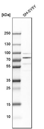 FUBP1 Antibody in Western Blot (WB)