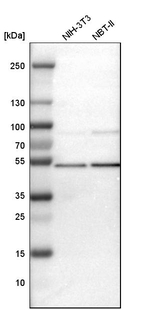 TSG101 Antibody in Western Blot (WB)