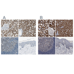 ACADM Antibody in Immunohistochemistry (Paraffin) (IHC (P))