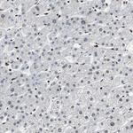 MTA2 Antibody in Immunohistochemistry (Paraffin) (IHC (P))
