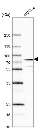 MTA2 Antibody in Western Blot (WB)