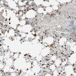 USP20 Antibody in Immunohistochemistry (Paraffin) (IHC (P))