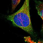 HPRT1 Polyclonal Antibody