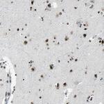 UBF-1 Antibody in Immunohistochemistry (Paraffin) (IHC (P))
