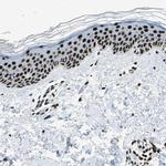 UBF-1 Antibody in Immunohistochemistry (Paraffin) (IHC (P))