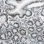 UBF-1 Antibody in Immunohistochemistry (Paraffin) (IHC (P))