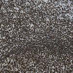 UBF-1 Antibody in Immunohistochemistry (Paraffin) (IHC (P))